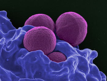 MRSA-Image MRSA-Image